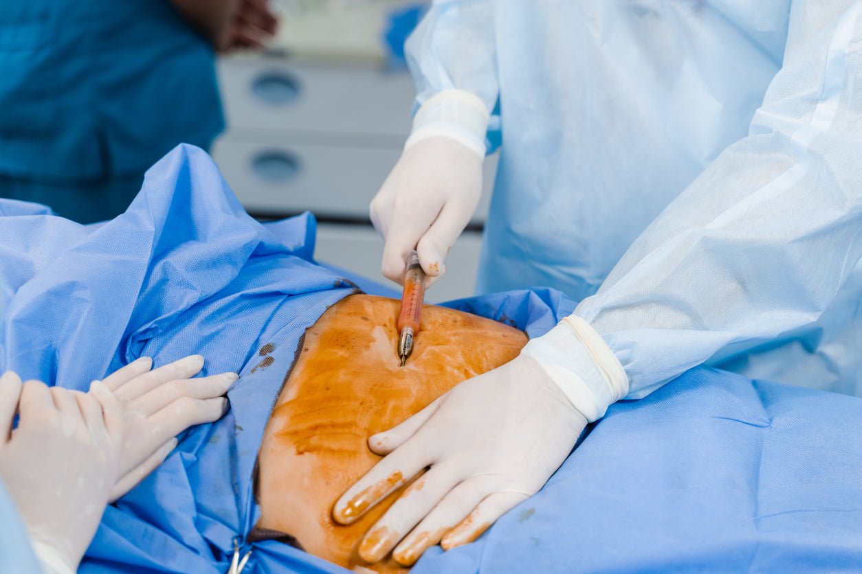 A Comprehensive Guide to Minimizing Scarring After Cosmetic Surgery - JDCareUSA