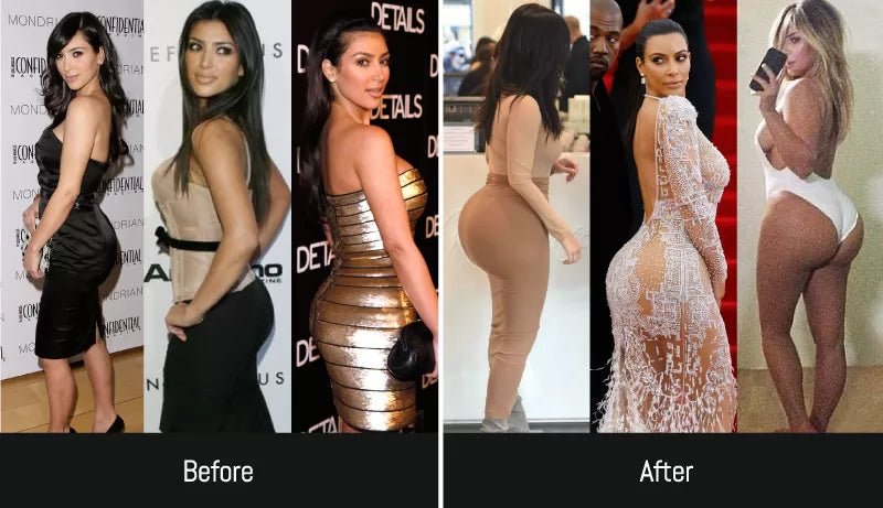 Top Alleged Celebrities Who've Had BBLs: Before and After Photos Exposed - JDCareUSA