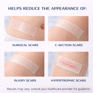 Scar Tape - Medical Grade Silicone (60 incHes) JDCareUSA